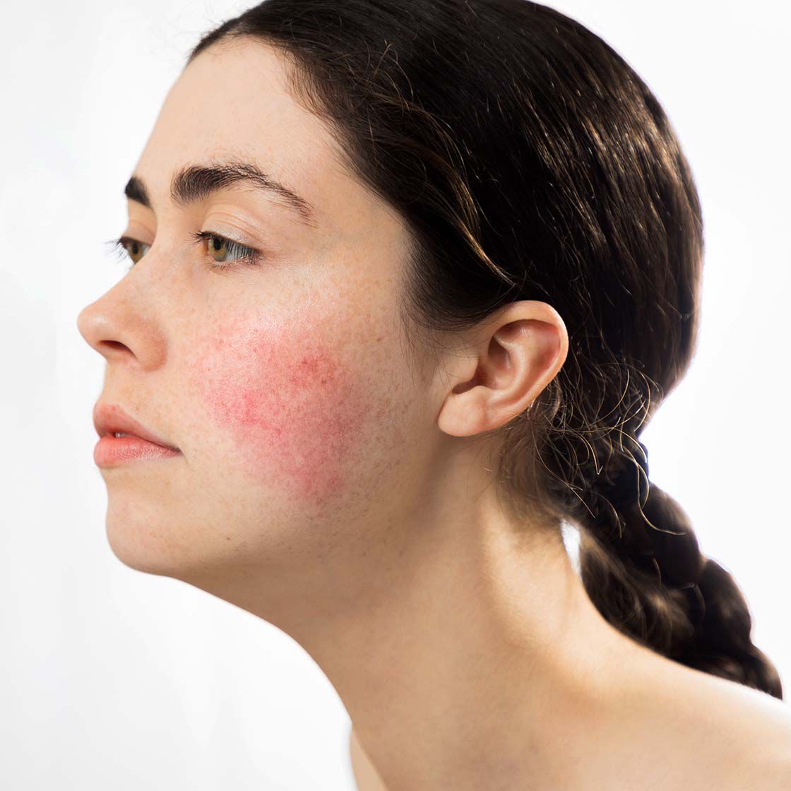 woman touching face