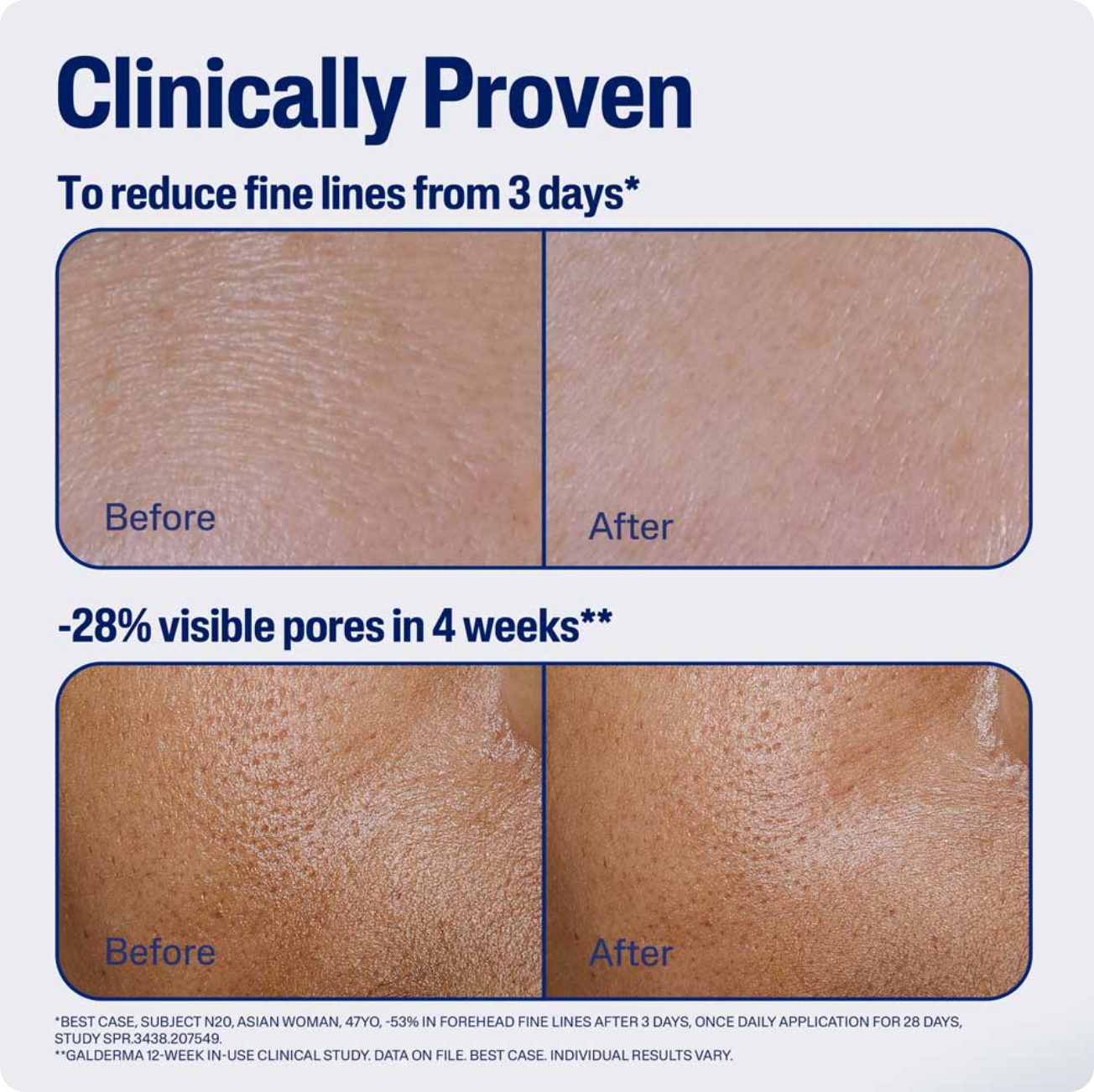 S&eacute;rum de d&eacute;fense avanc&eacute;