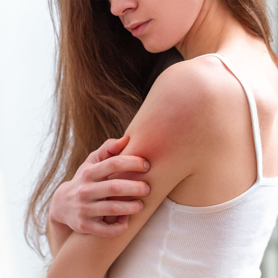 VOTRE GUIDE POUR LA PEAU SENSIBLE : DESCRIPTION, CAUSES, SIGNES ET PLUS ENCORE