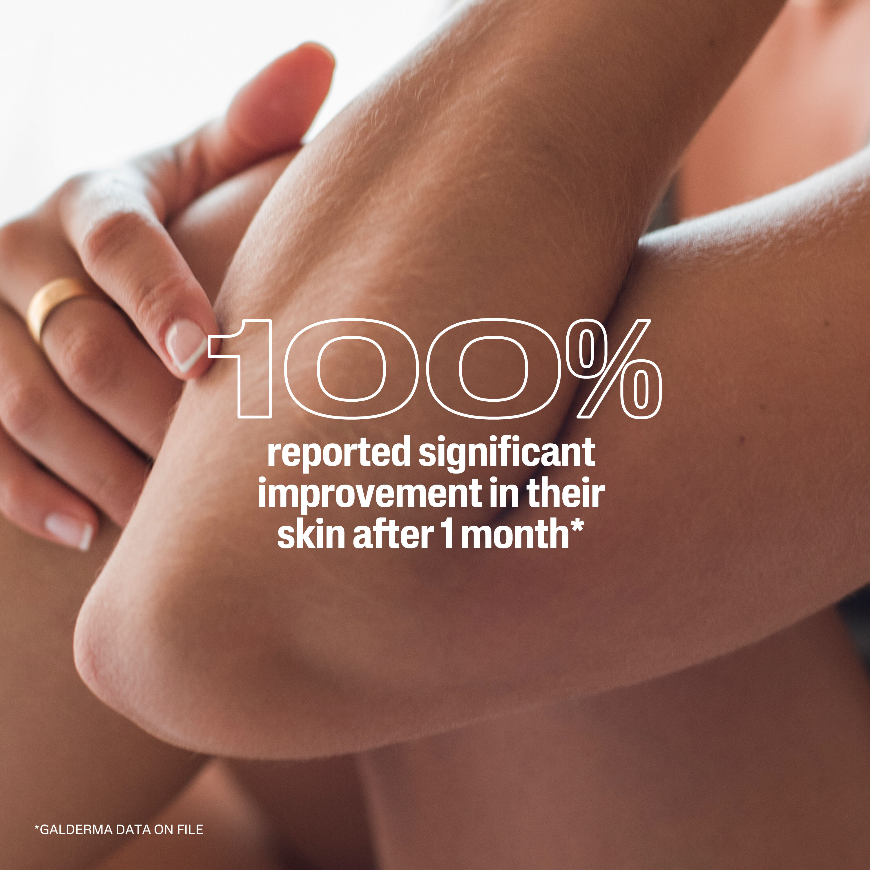 LOTION R&Eacute;PARATRICE UR&Eacute;E 10