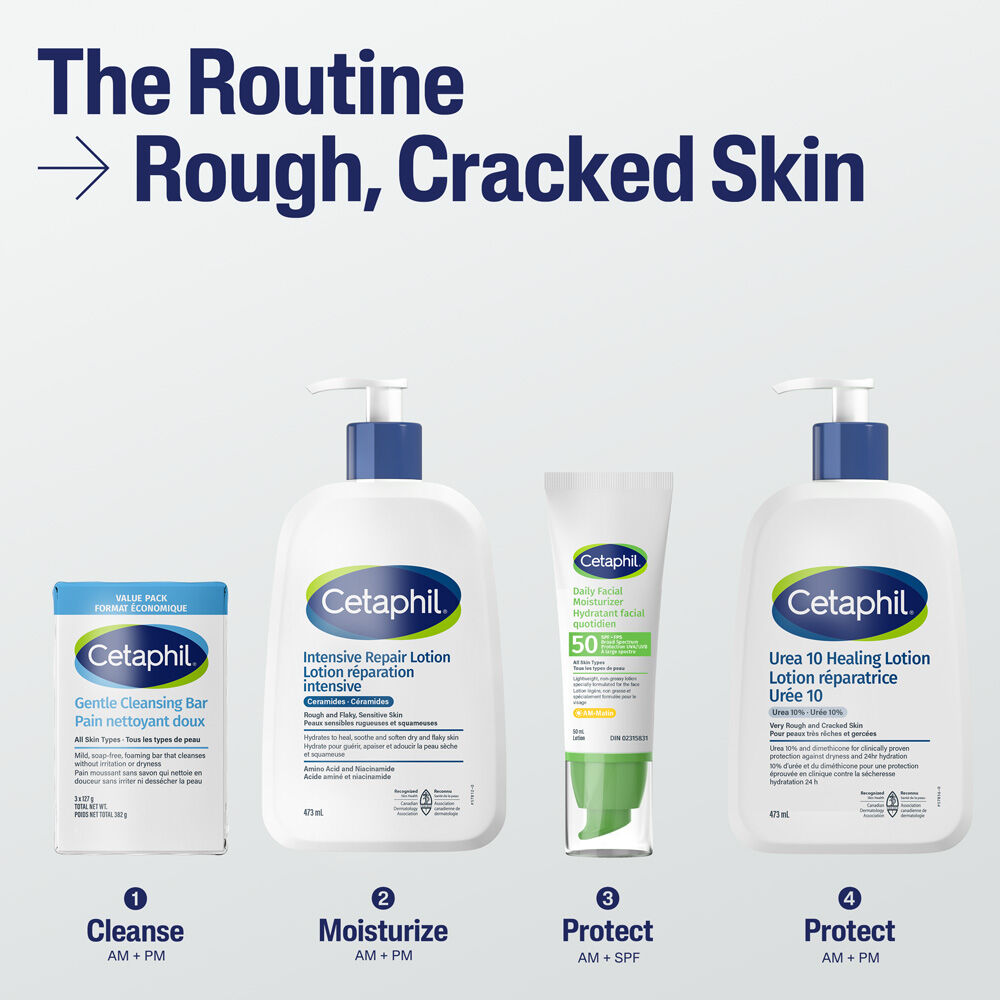 LOTION R&Eacute;PARATRICE UR&Eacute;E 10