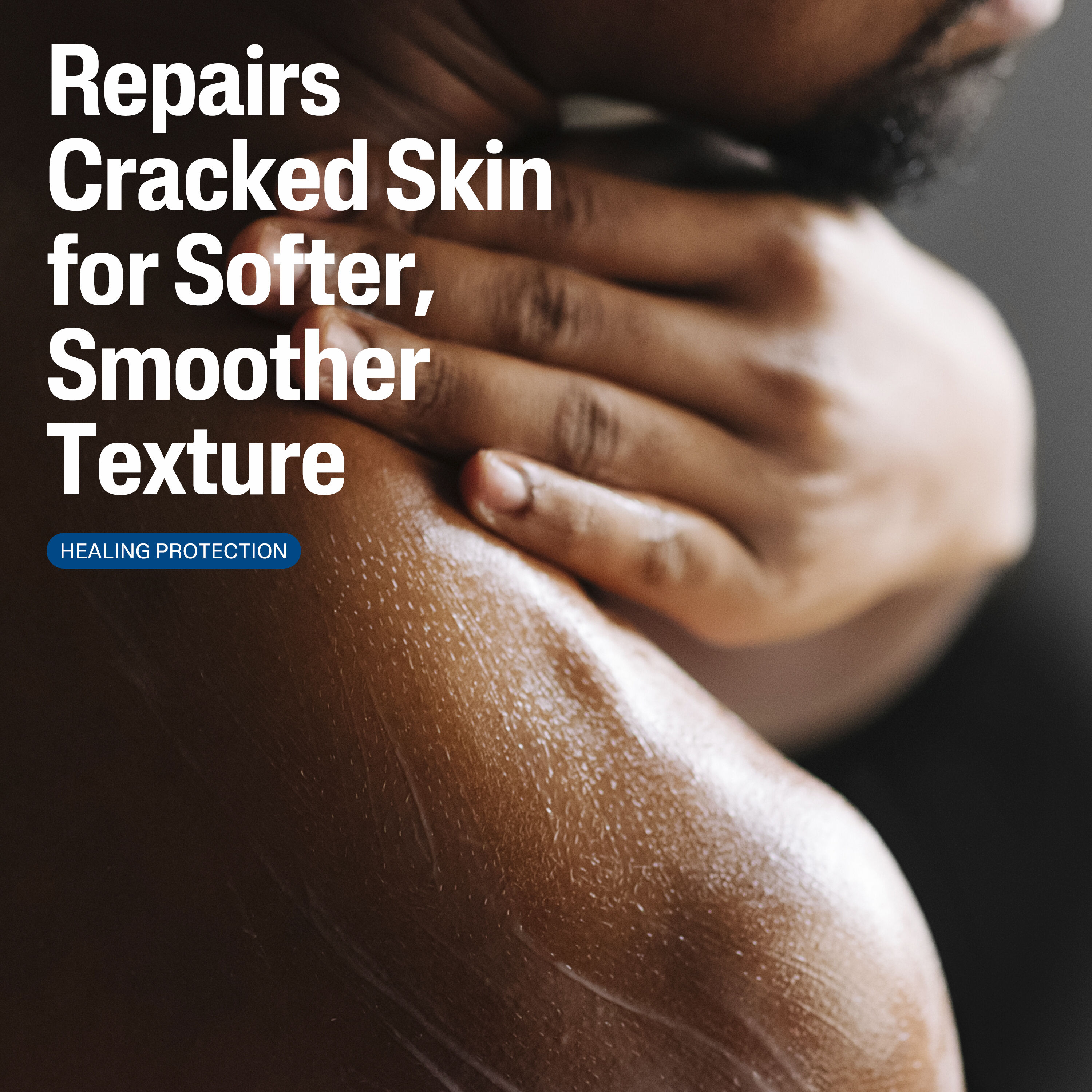 LOTION R&Eacute;PARATRICE UR&Eacute;E 10